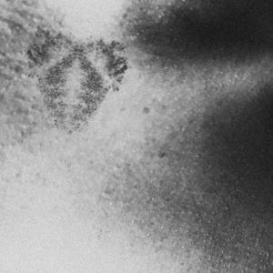 bruise (slowed + reverb) (feat. 3nye & Von Arete)