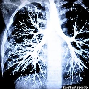 Bronchial Tree