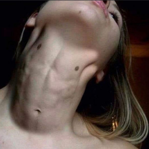 Throat !!!!