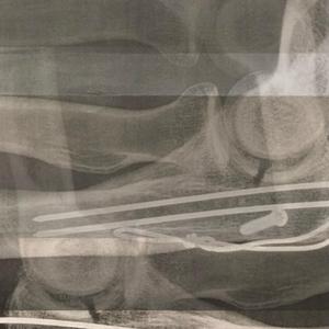 The Summer of Mom's Mad