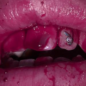 DÓLARES (feat. effypercodeine)
