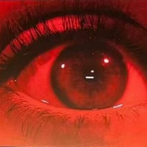 梦2.1