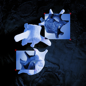 Totem Collapse (Remix)