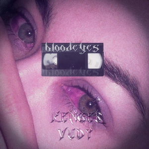 Bloodeyes