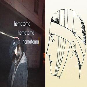 hematoma