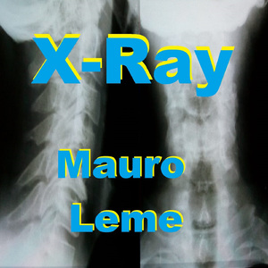X-Ray
