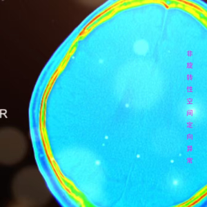 非旋转性空间定向异常.WAV
