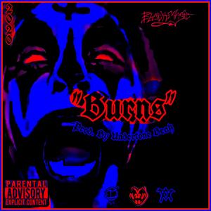Burns