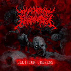 Cephalotrigeminal Angiomatosis