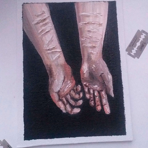 Старые шрамы