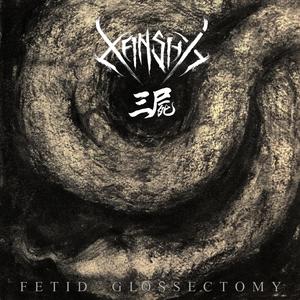 Fetid Glossectomy