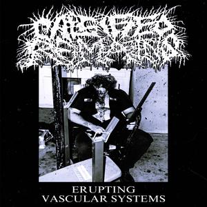 1. CAUSTIC MYOCLONUS 2. DEGLOVED IN SECONDS 3. WHICH LIMB? 4. EVIDENCE DESTROYED 5. GUILLOTINE ERROR 6. CONCRETE GRAVE 7. ERUPTING VASCULAR SYSTEMS