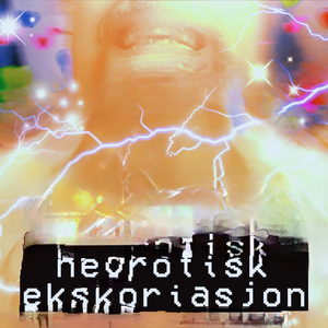 ನರಸಂಬಂಧಿ ಹೊರಸೂಸುವಿಕೆ