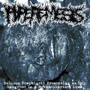 BULLOUS PEMPHIGOID PRESENTING AS DRY GANGRENE IN A REVASCULARIZED LIMB