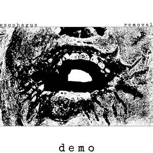 Pnuemocysticfibrosis