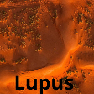 Lupus