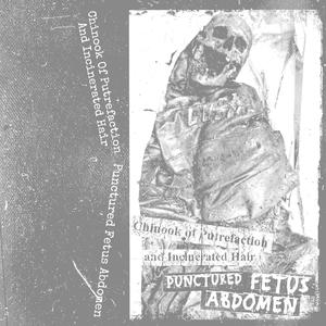 A Lesson On Organogenesis (Punctured Fetus Abdomen)