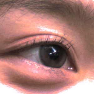 过去发霉刺痛皮肤