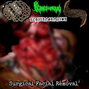 Trombiculid Flesh Eruption