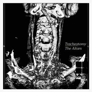 Tracheotomy