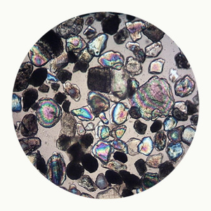 R Eflex (Anthony Shake Shakir Remix)