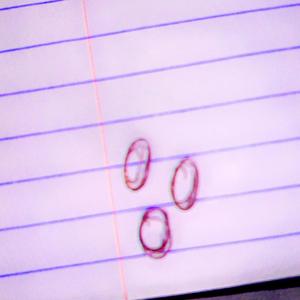 lenses