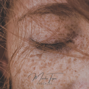 Freckles