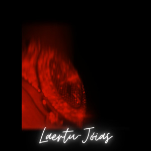 Jóias
