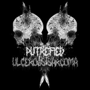 Autoerotic Anoxemia
