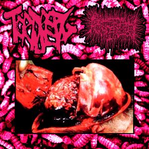 Paraphilic Psychosis