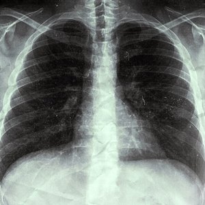 Abrázame y no me sueltes