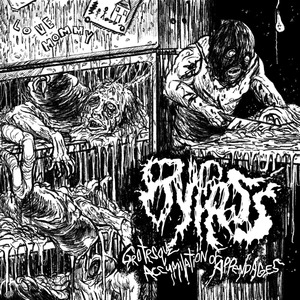 Hemispherectomy
