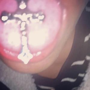 glistening