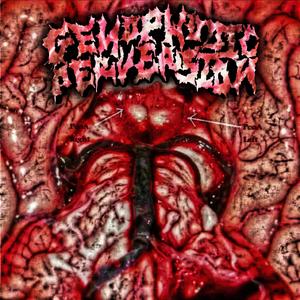 Embolic Obstruction of Major Cerebral Pathways