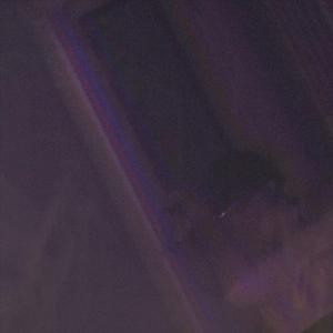 Neuralink isn't Out Yet