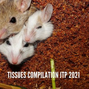 Action Now (Radio Vrs.)