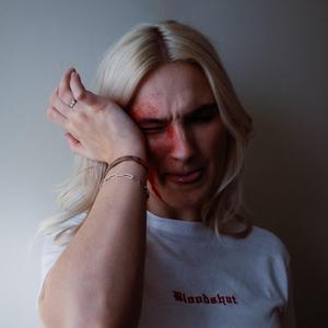 Bloodshot