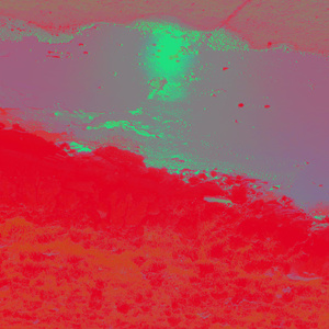 RANDOM