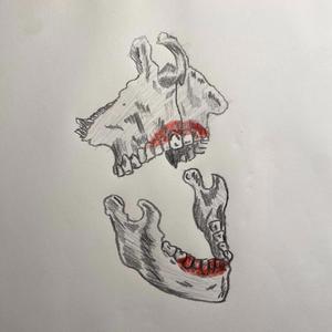 A Bullet Can Cure Cancer