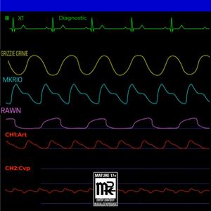 DIAGNOSTIC (feat. Rawn, Grizzie Grime & Mkrio)