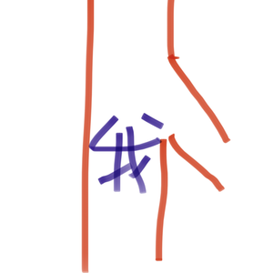 我寄人间雪满头 feat.洛天依ai