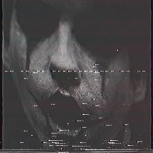 Red Knuckles and Bloodbath (noise mix)