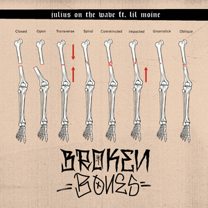 BROKEN BONES