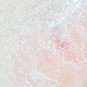 endless nocturnal(lengthy slumber)