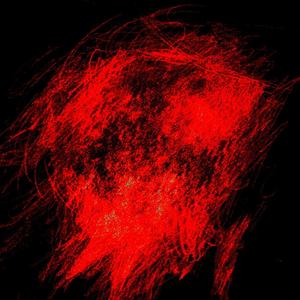 Schizophrenia (feat. ADD1XSS) (ADD1XSS Remix) (ADD1XSS Remix)