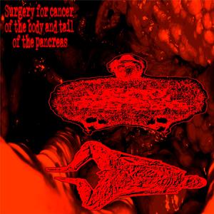 Untitled Improvisation No. VI