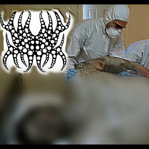 Obese Bloated Body Putrefaction
